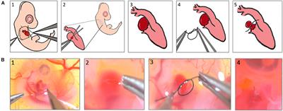 Blood Flow Disturbance and Morphological Alterations Following the Right Atrial Ligation in the Chick Embryo